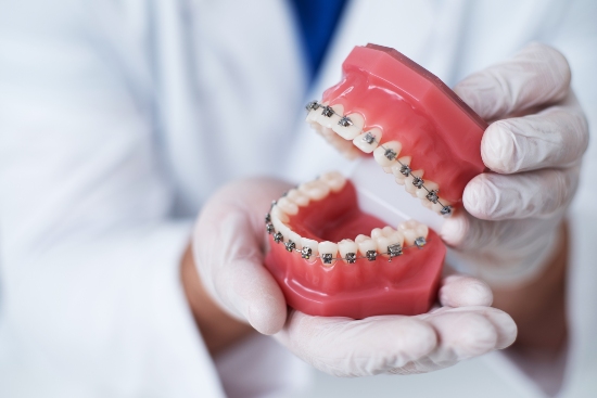 Orthodontic Treatment in St. George, UT