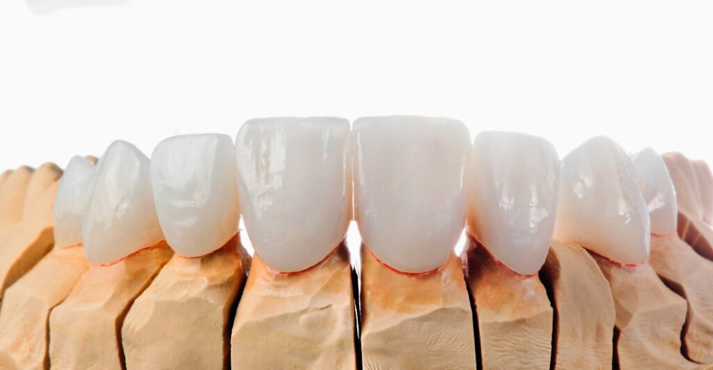 Wide Range of Restorative Dentistry Services in St. George, UT